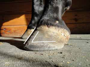 Coffin bone placement on a tall hoof.